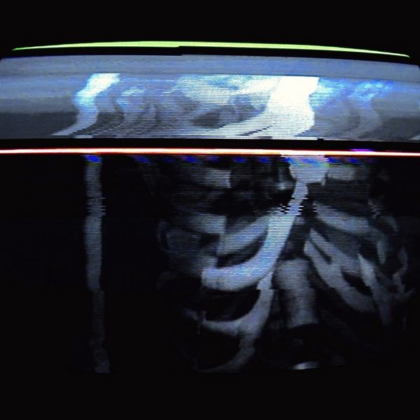 Carcass - Bones | MixtapeMonkey.com